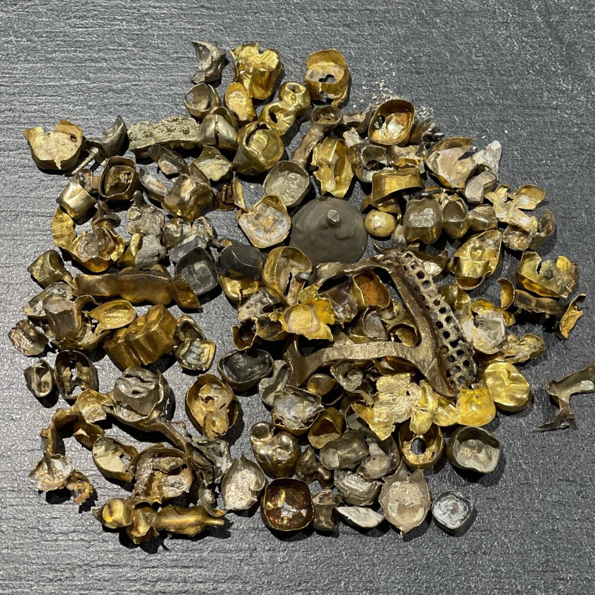 Que faire de mon or dentaire et comment en récupérer le meilleur prix ?